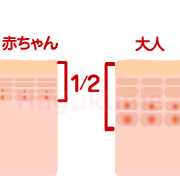 乳児湿疹の原因